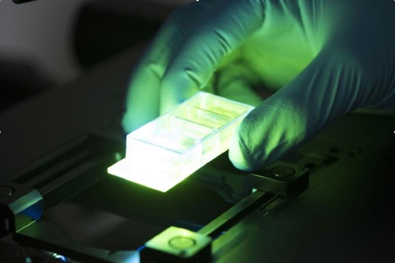 DNA-stabilisierte Metall-Quanten-Cluster sollen als hochempfindliche, kostengünstige Biosensoren eingesetzt werden. Mit ihren Fluoreszenzeigenschaften können Krankheiten zuverlässig detektiert werden.
