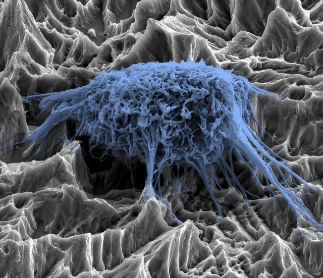 Rasterelektronen-mikroskopische Aufnahme einer gut angewachsenen Zelle auf einem Zahnimplantat